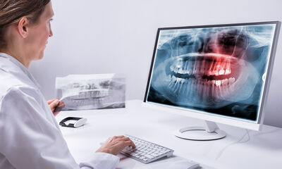 Implants et prothèses dentaires Un voyage pour retrouver le sourire Implants et prothèses dentaires Un voyage pour retrouver le sourire